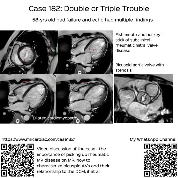 Case 182: Double or Triple Trouble