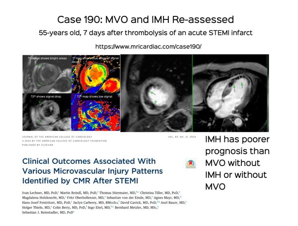 Case 190: MVO and IMH Re-assessed