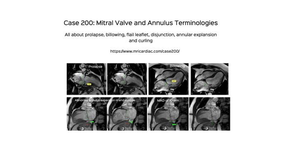 Case 200: Mitral Valve and Annular Terminologies