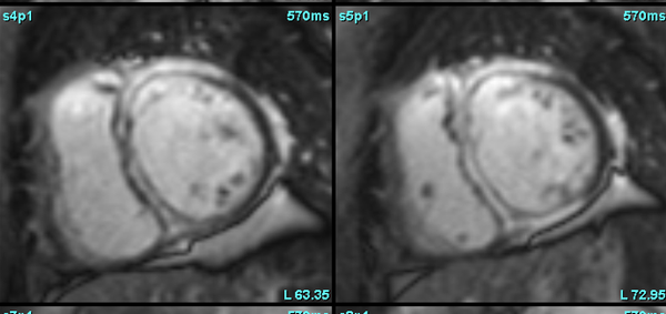 CMR decoding pathology!