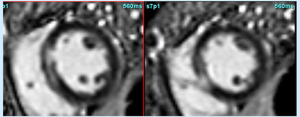 Heart-Gut connection