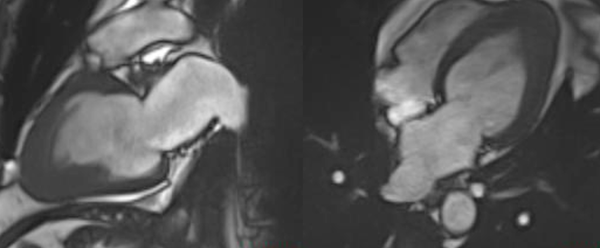 When in doubt, List it out!