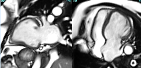 Multifaceted role of CMR