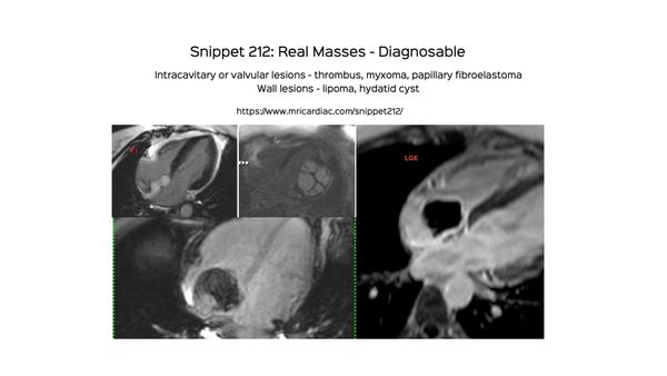 Snippet 212: Real Masses - Diagnosable