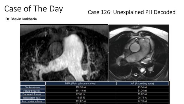 Case of the Day 126 - Unexplained Pulmonary Hypertension Decoded