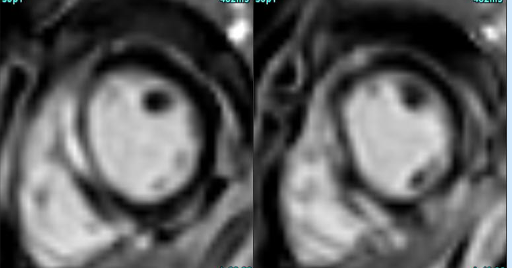 Routine case: Real danger