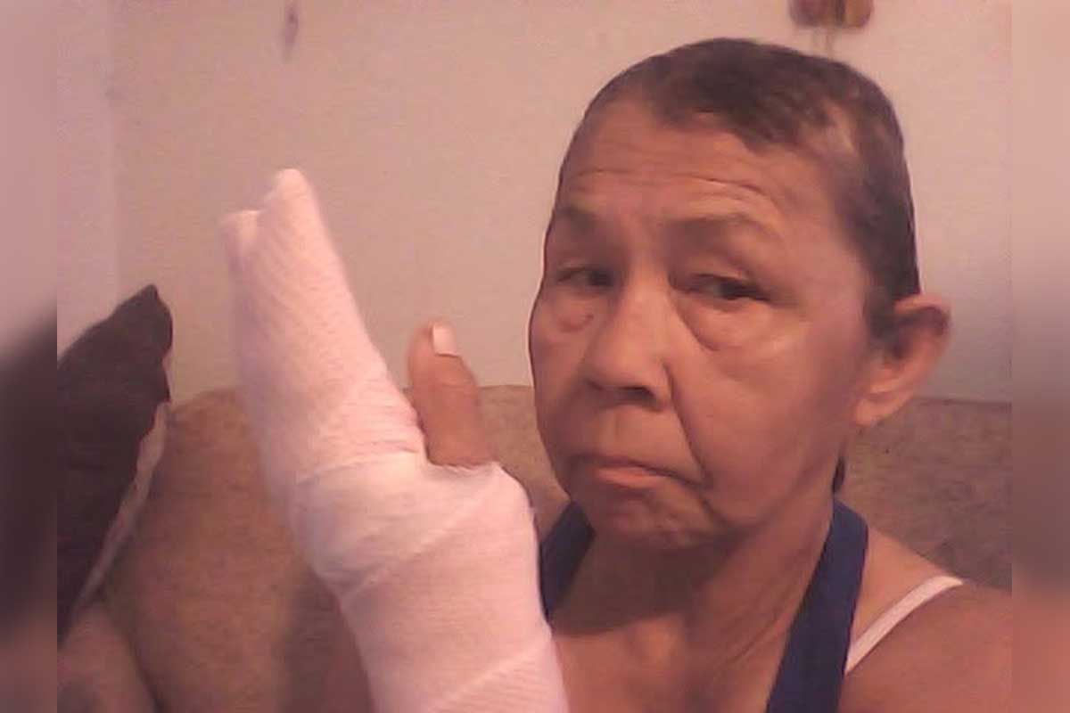 Wiikwemkoong woman seriously injured in random pitbull attack