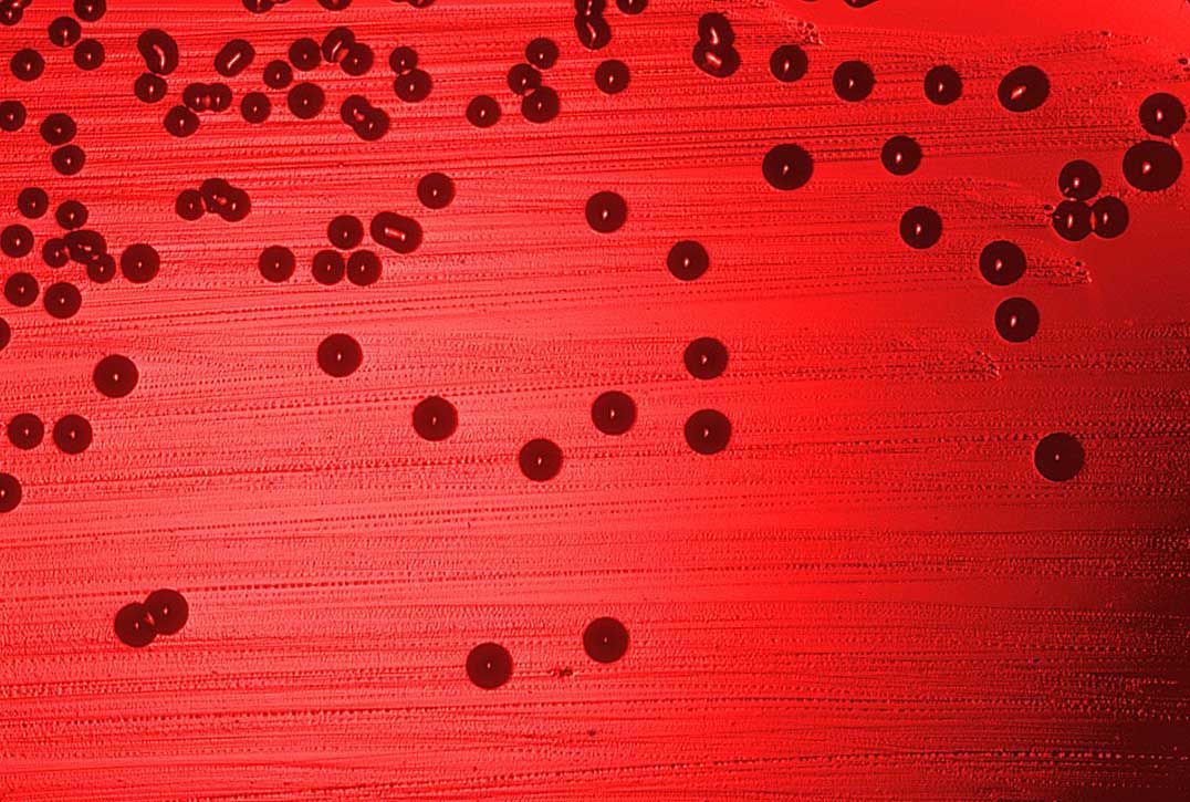 NOSM Researcher Participating in Nationwide  Haemophilus influenzae type a (Hia) Vaccine Study