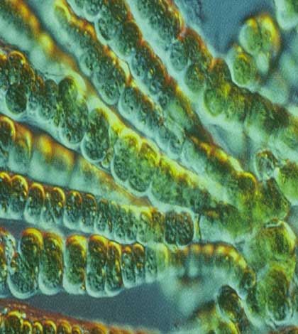Blue-green algal bloom reported in Tobacco Lake and Lake Wolsey