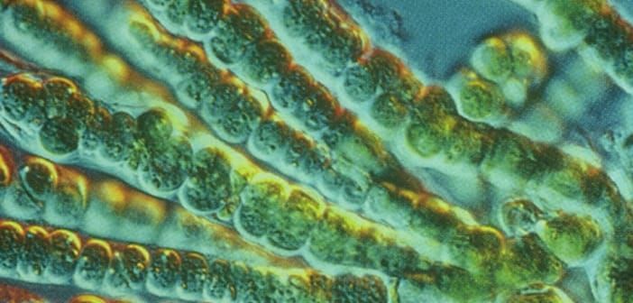 Blue-green algae bloom reported in Long Lake