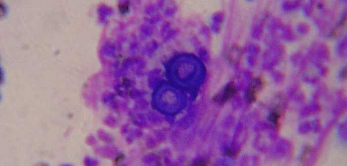 Islanders warned to be wary of potentially deadly blastomycosis