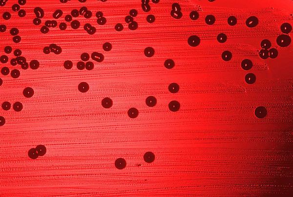 NOSM Researcher Participating in Nationwide  Haemophilus influenzae type a (Hia) Vaccine Study