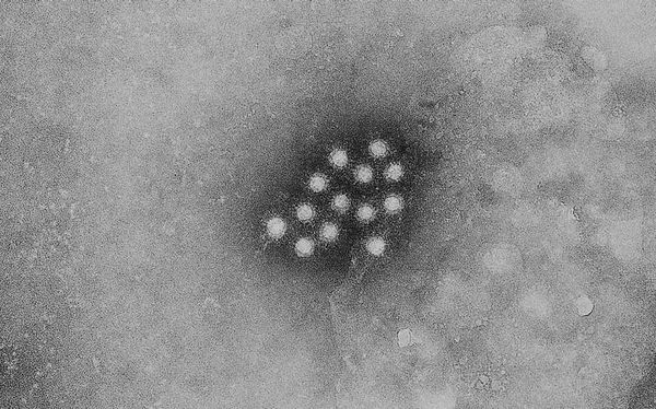 Local hepatitis A case linked to national outbreak