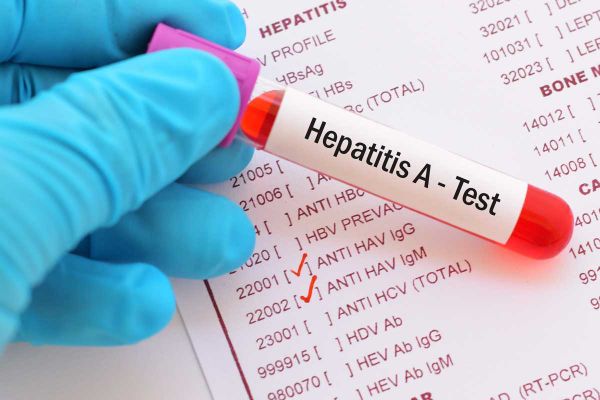 Second case of hepatitis A confirmed in deli worker: vaccine offered to more people