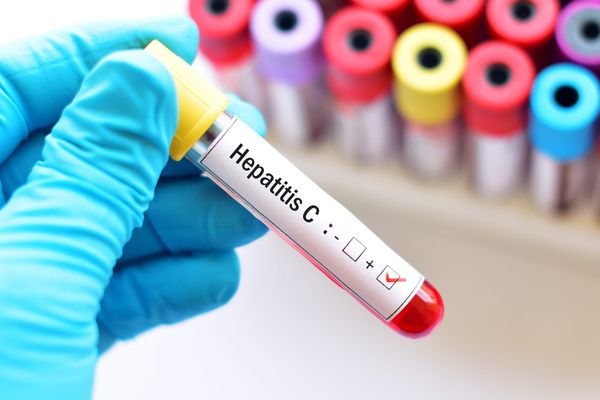 Hep C program offers cash for a cure in vulnerable populations
