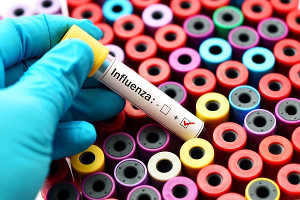 First case of influenza confirmed locally