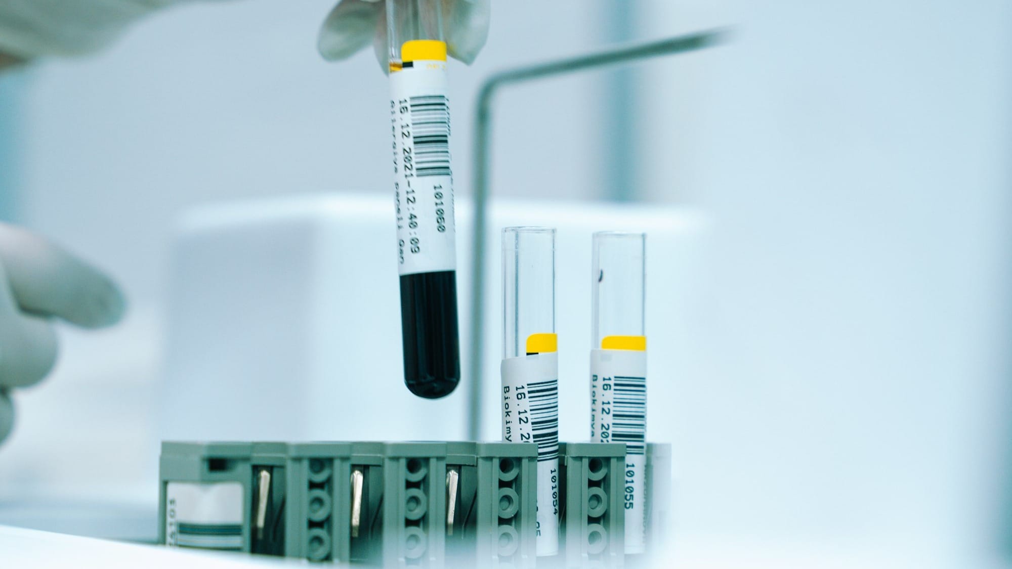 A gloved hand holding a test tube filled with blood.