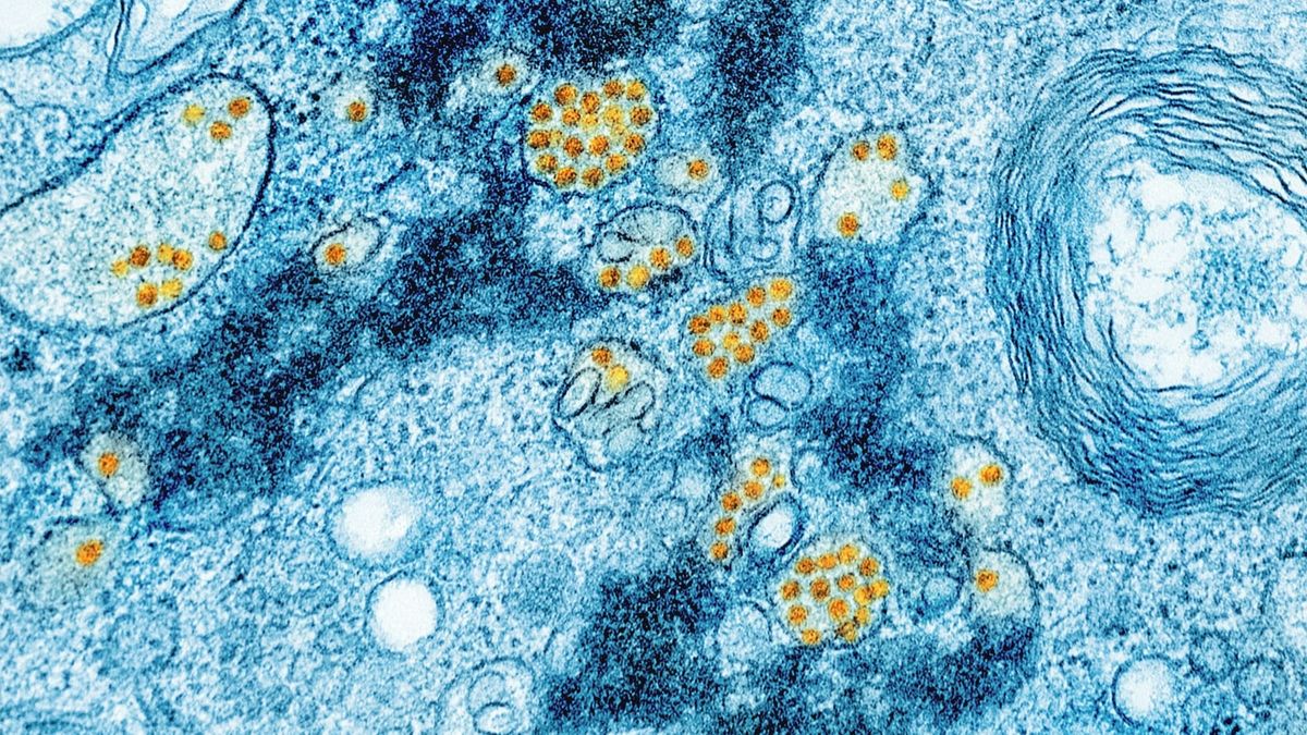 Fasting and Autophagy: What the Evidence Actually Shows