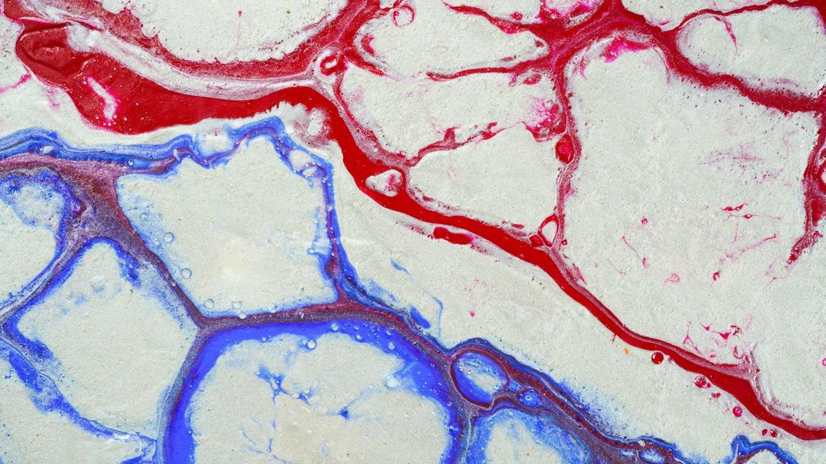 Microscope image of blood vessel