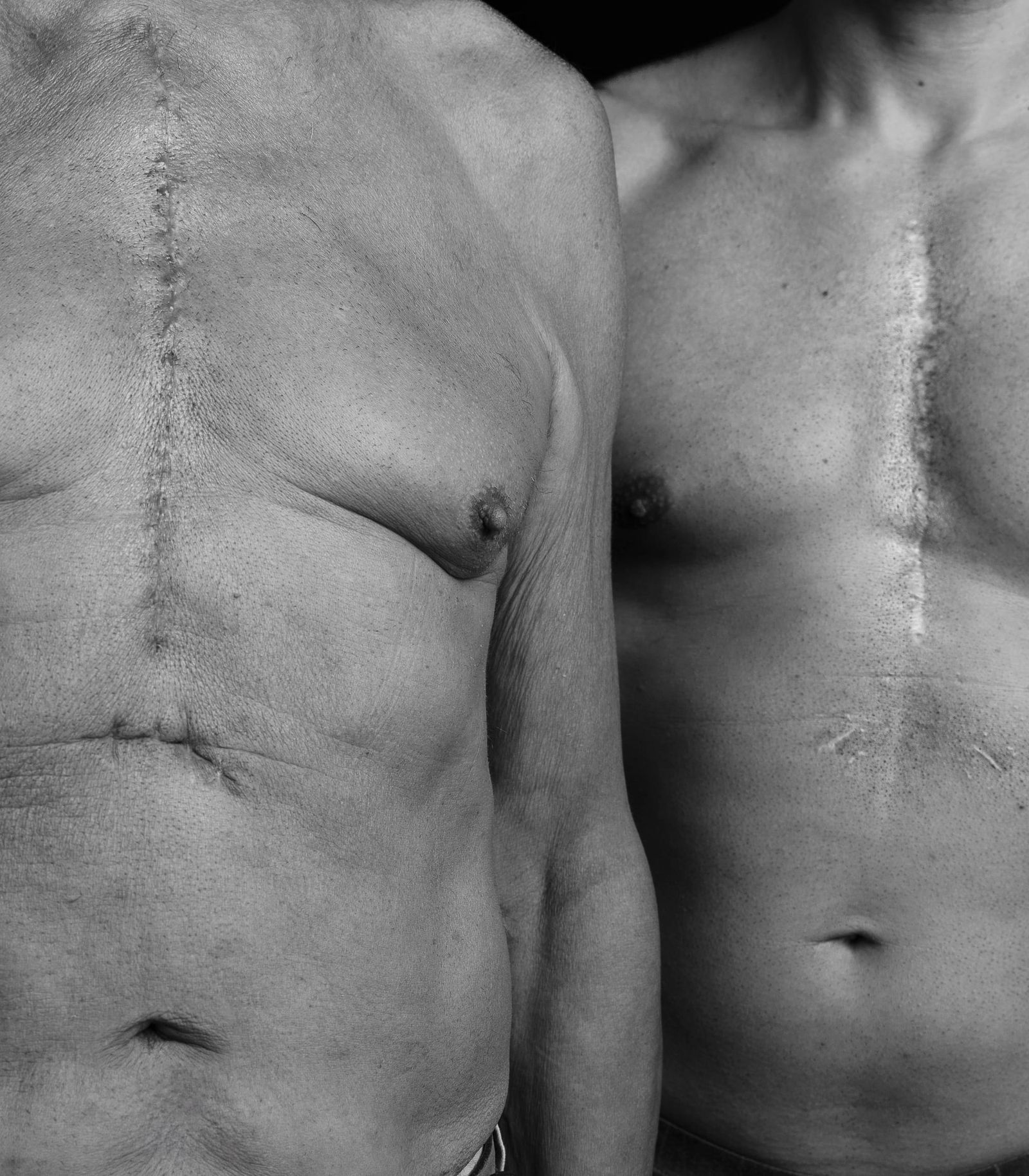 Una storia di cicatrici