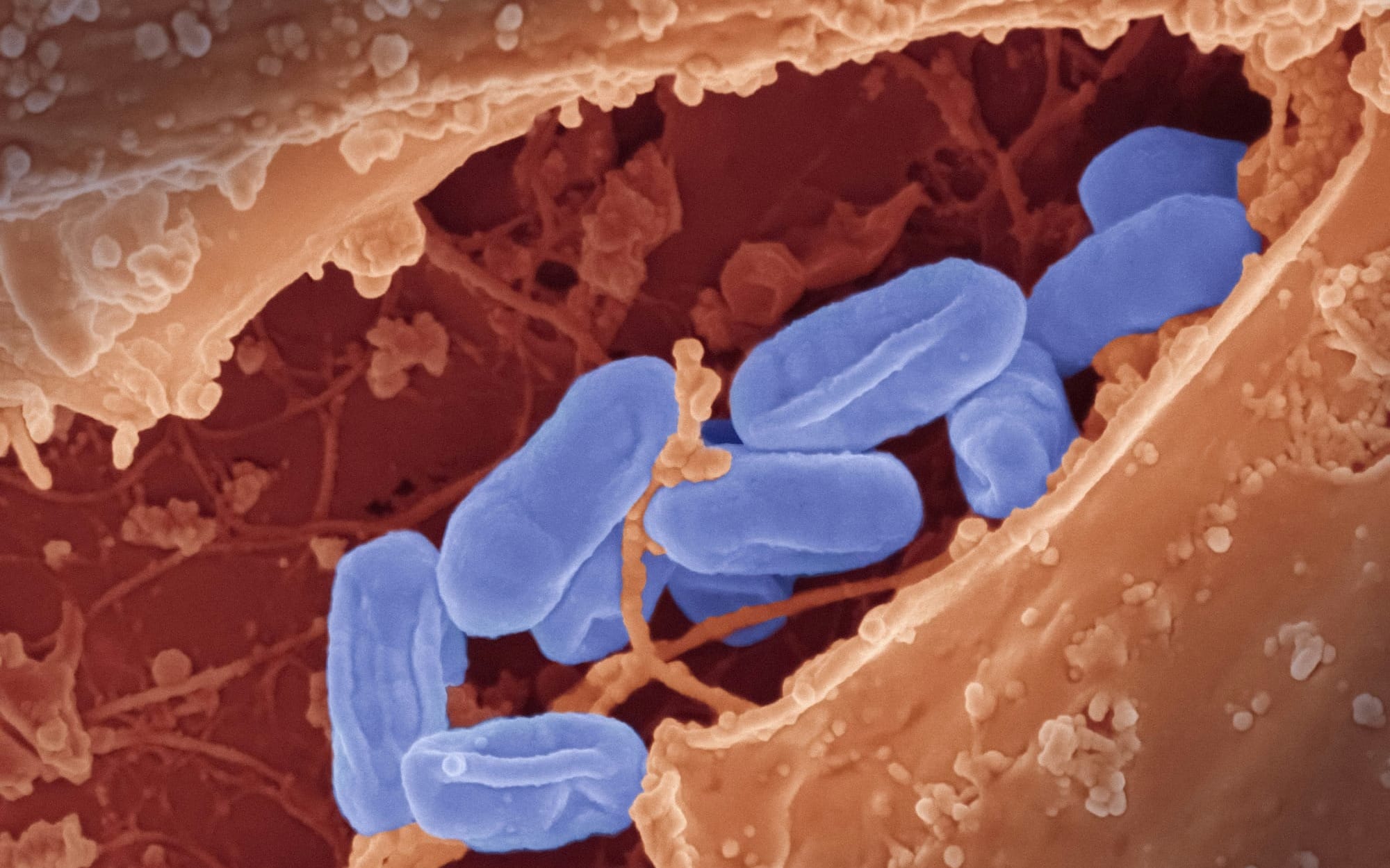 A high-magnification scanning electron micrograph concept showing a cluster of blue, rod-shaped bacterial pathogens nestled deep within a textured brown cellular tissue crevice, illustrating the hidden nature of tick-borne co-infections.