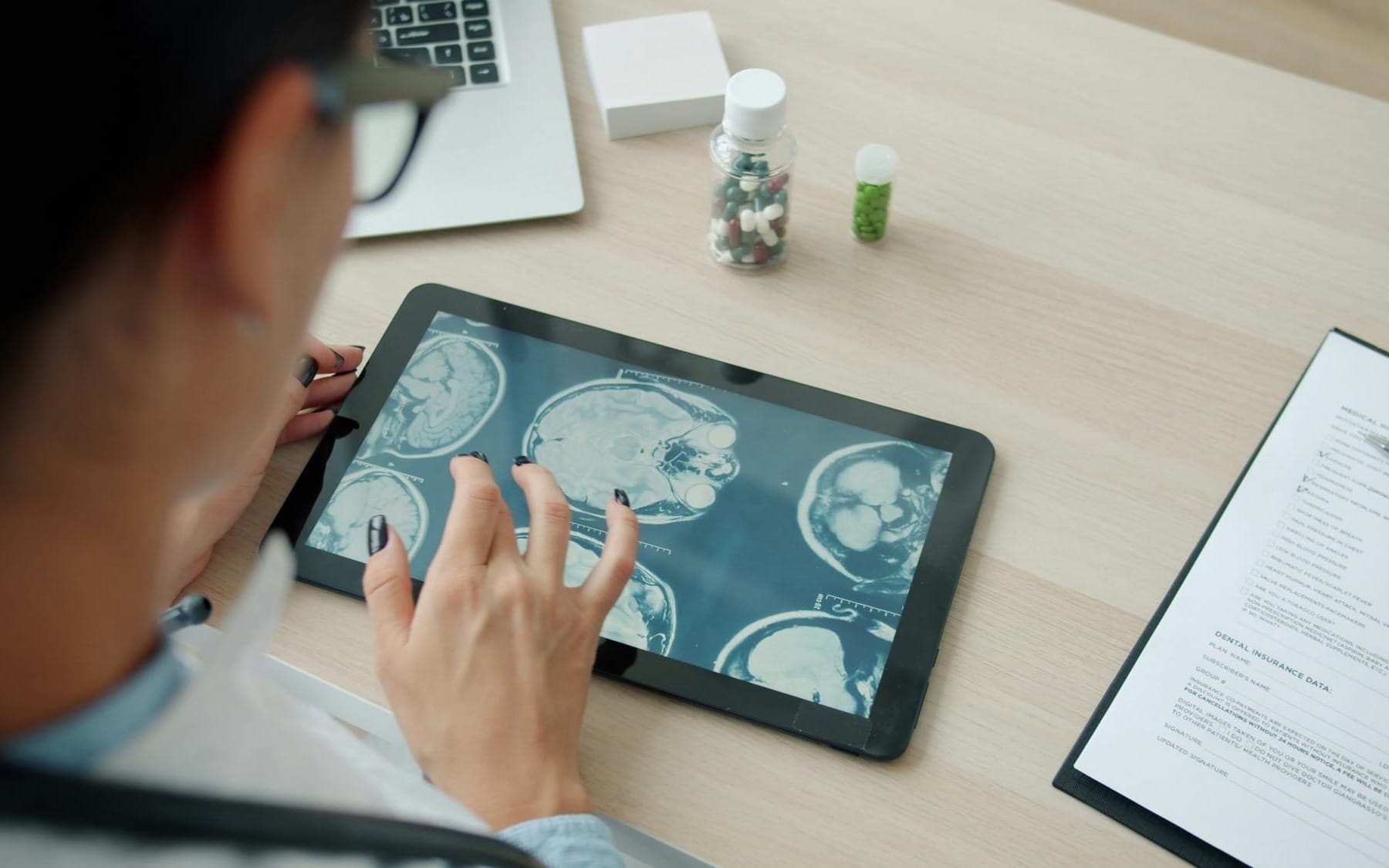 Over-the-shoulder view of a health practitioner reviewing cross-sectional brain scans on a digital tablet at a medical clinic desk, demonstrating diagnostic neuroimaging for cognitive care.