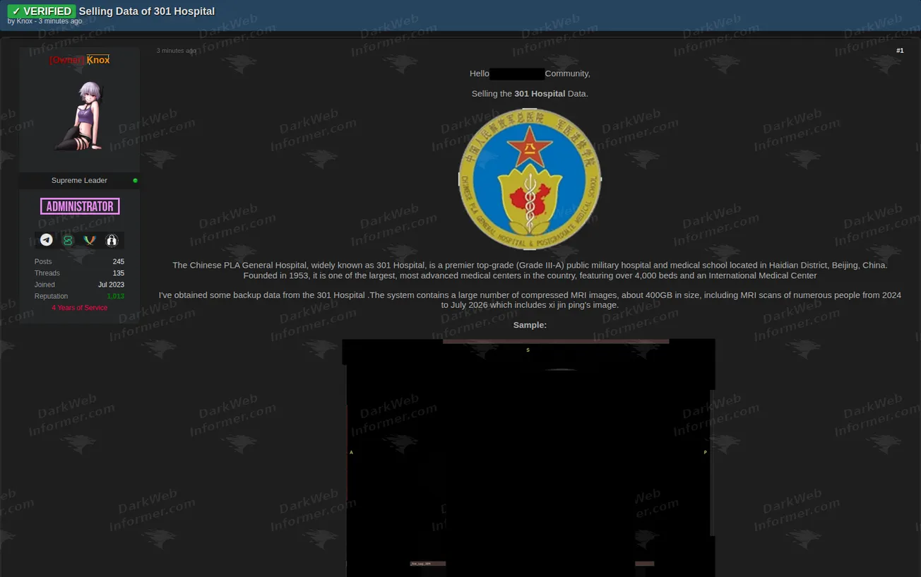 301 Hospital Beijing medical imaging data sale forum post screenshot, August 2026