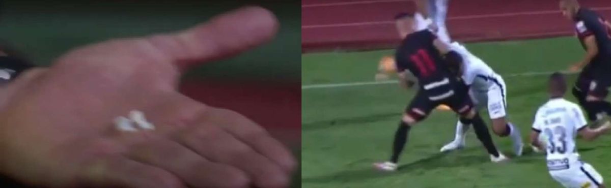 Nietypowa sytuacja w meczu ligi brazylijskiej! Piłkarz stracił cztery zęby [WIDEO] Zdjęcie główne wpisu