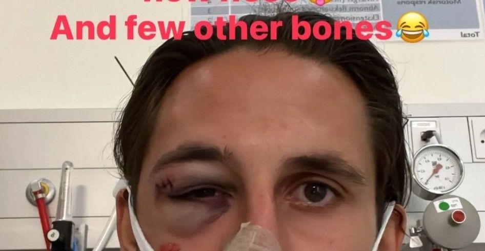 Kamil Grabara pokazał kibicom efekt zderzenia z zawodnikiem Aalborga. „Przez pewien czas nie zobaczycie mnie na boisku” Zdjęcie główne wpisu