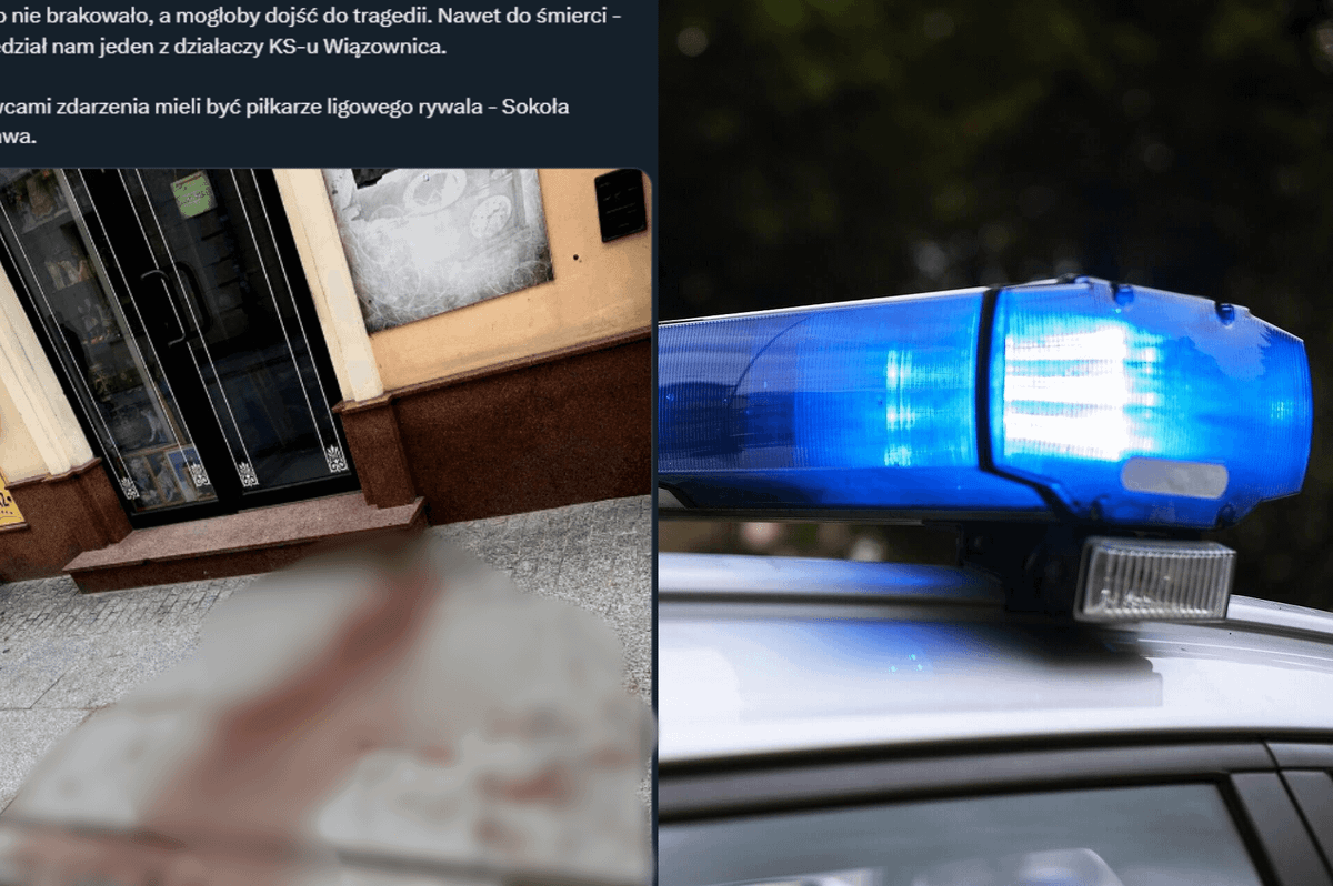 Ogromny skandal. Piłkarz trafił do szpitala po pobiciu przez zawodników innego klubu. „Pojawiła się krew” Zdjęcie główne wpisu