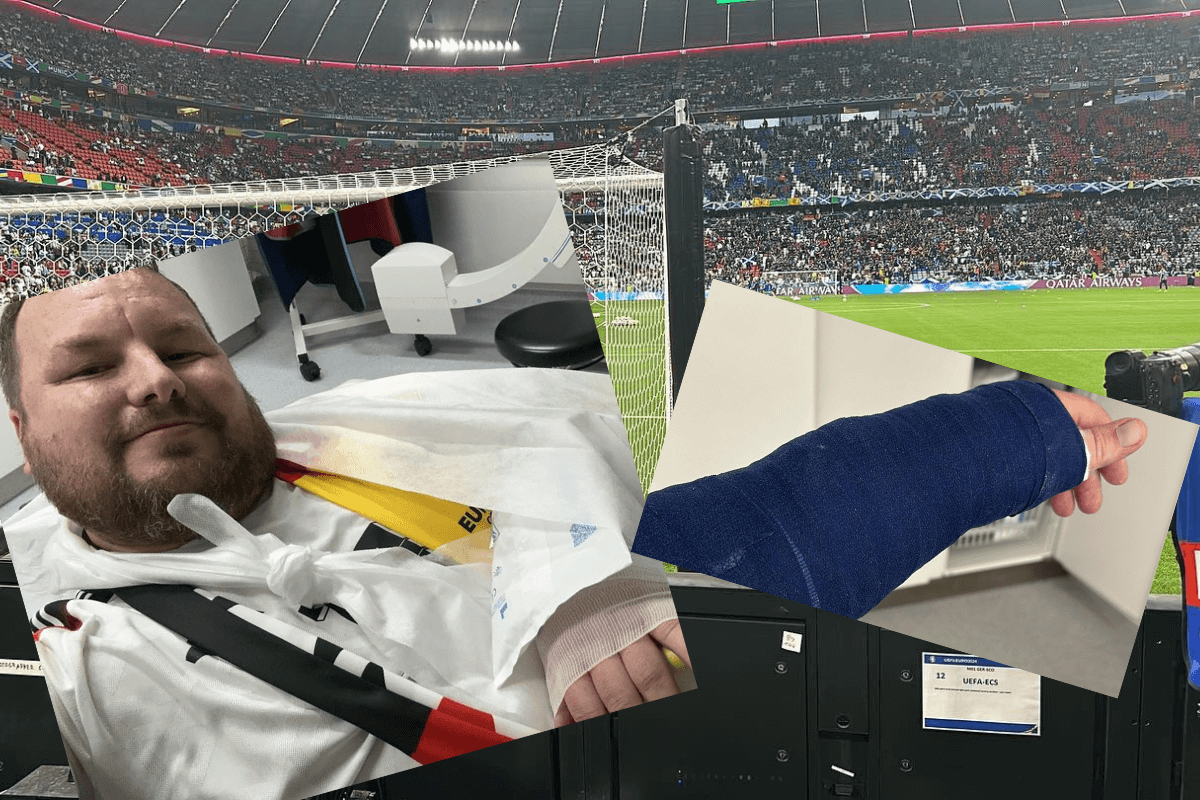 Pech kibica reprezentacji Niemiec. Fuellkrug złamał mu rękę tuż przed rozpoczęciem meczu ze Szkocją Zdjęcie główne wpisu