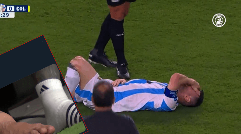 Tak wyglądała noga Messiego po urazie w finale Copa America. Boli od samego patrzenia Zdjęcie główne wpisu