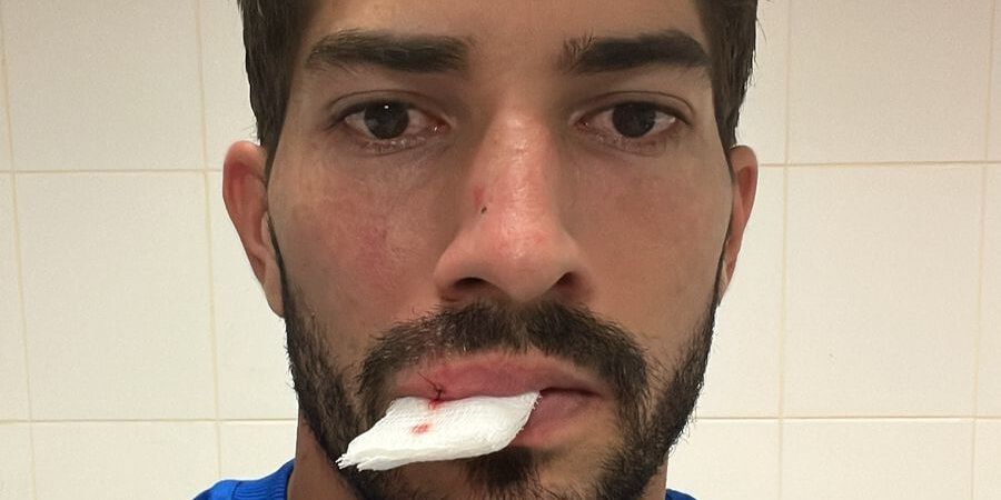 Skandaliczna sytuacja w Brazylii. Lucas Silva uderzony telefonem z trybun Obraz wpisu