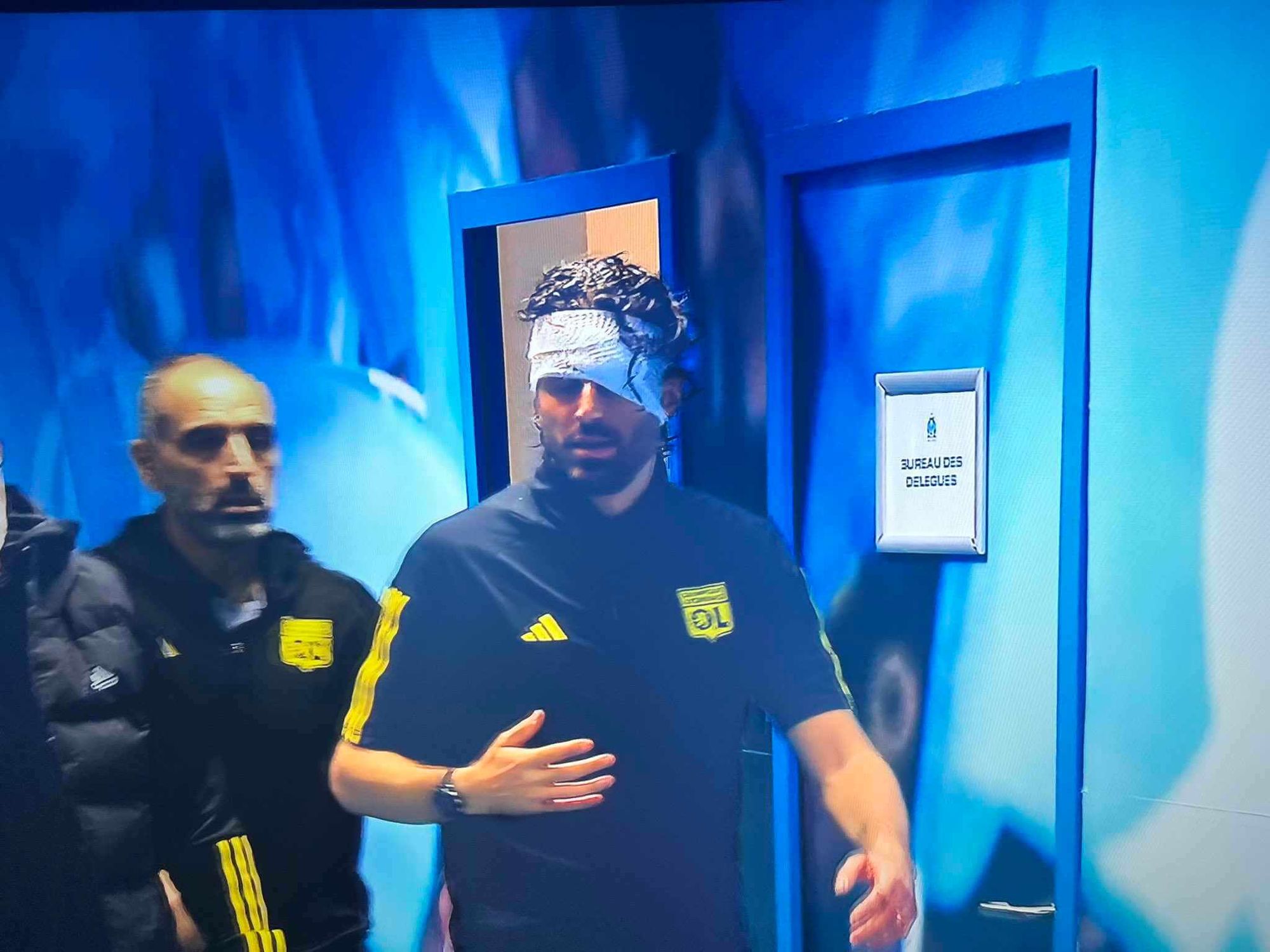 Skandal przed hitem w Ligue 1! Kibole zaatakowali autokar, trener dostał kamieniem [WIDEO] Obraz wpisu
