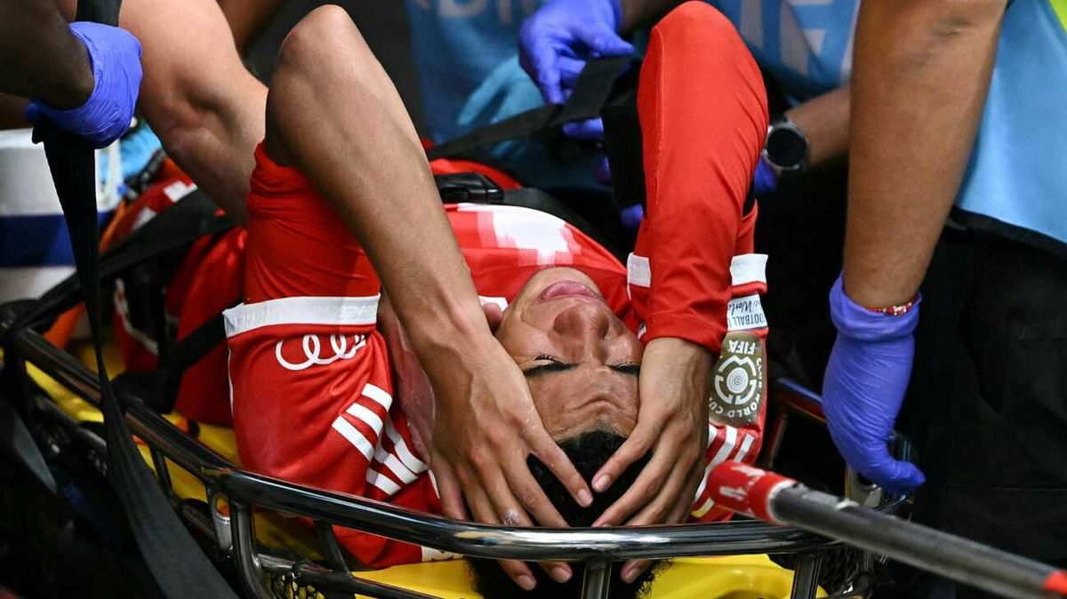 FC Bayern: Musiala erleidet Wadenbeinbruch