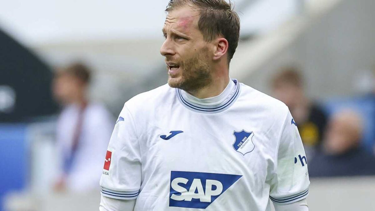 Baumann fehlt Hoffenheim mit Gehirnerschütterung