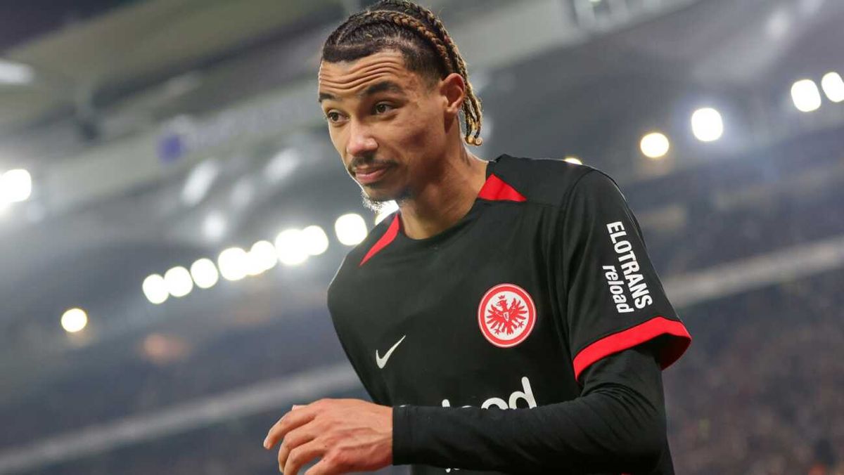 Ekitike: Lieber Adler auf der Haut als im Haar