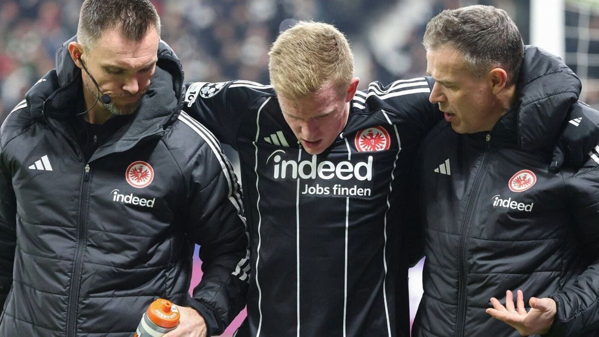 Toppmöller nach Burkardt-Ausfall: "Genug Optionen"