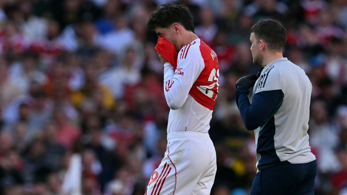 Arsenal: Havertz verpasst Halbfinal-Hinspiel in Madrid