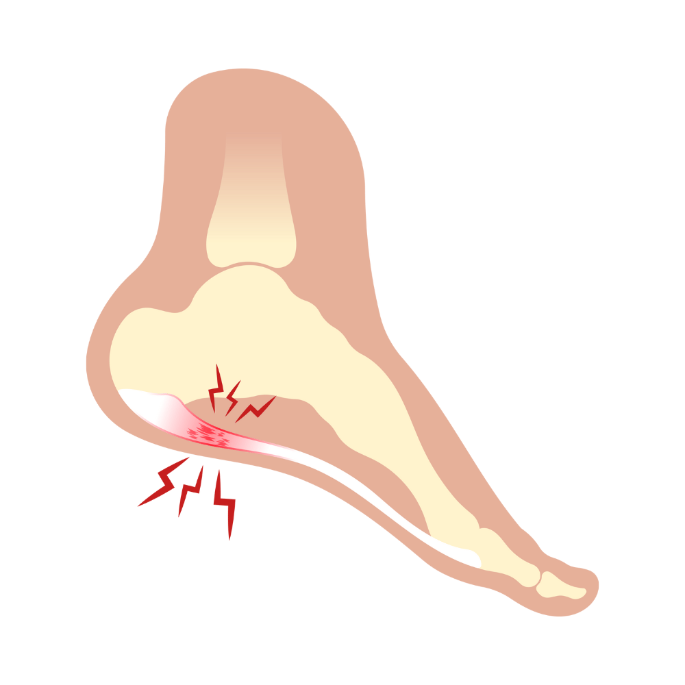 5 Best Socks For Plantar Fasciitis To Buy - Handy Buying Guide