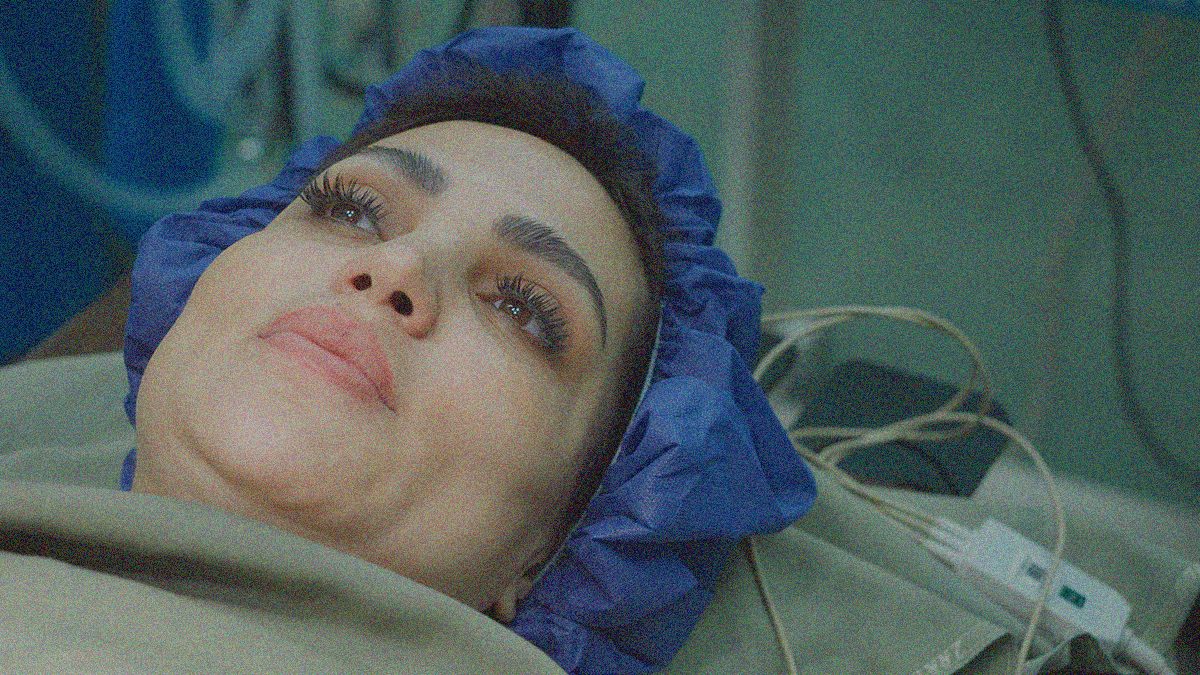 Close-up of a woman's face awaiting surgery on the operating table.