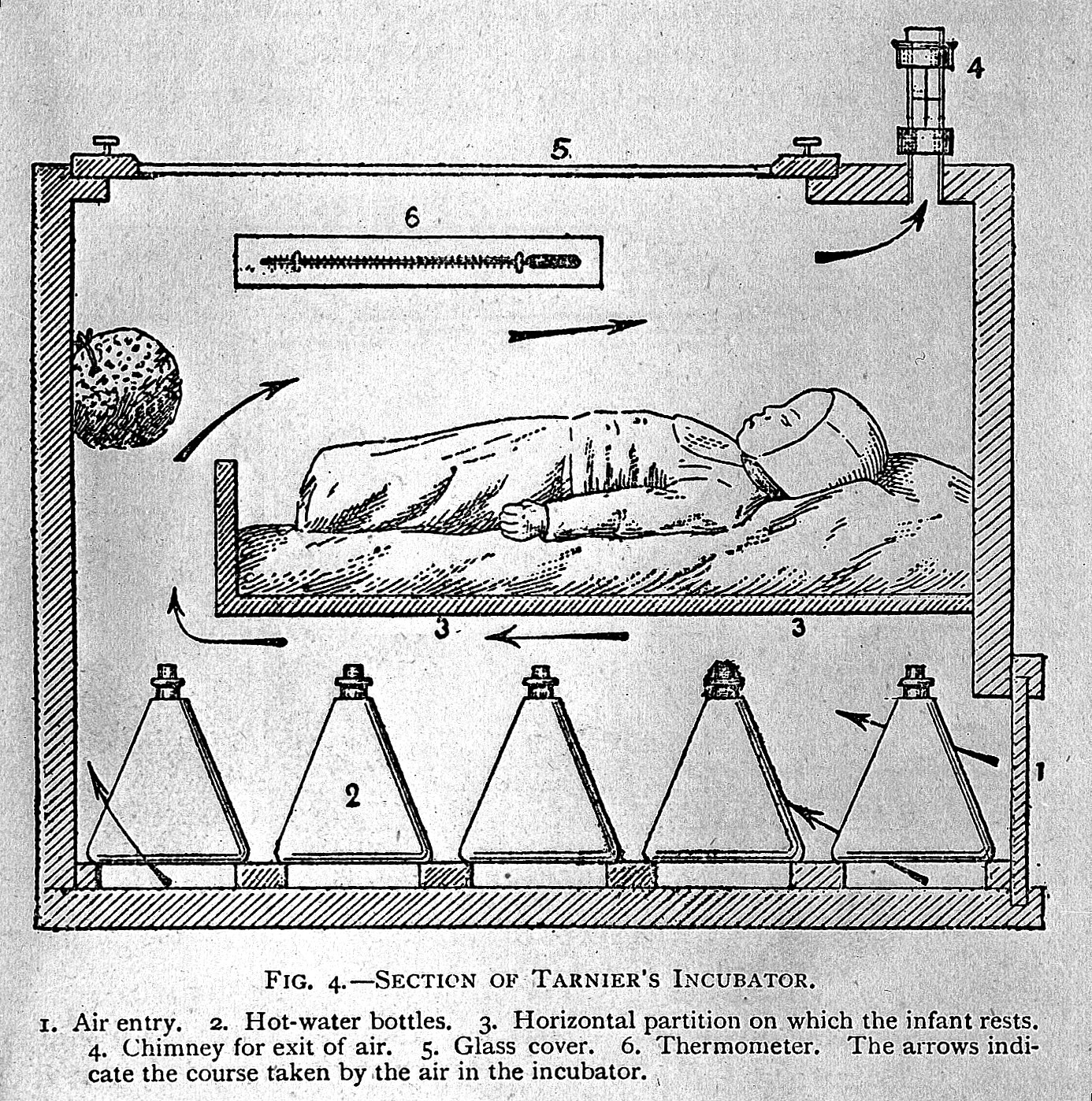 Illustration of Tarnier's incubator, showing internal components including hot-water bottles, air entry points, and a baby resting on a horizontal partition.