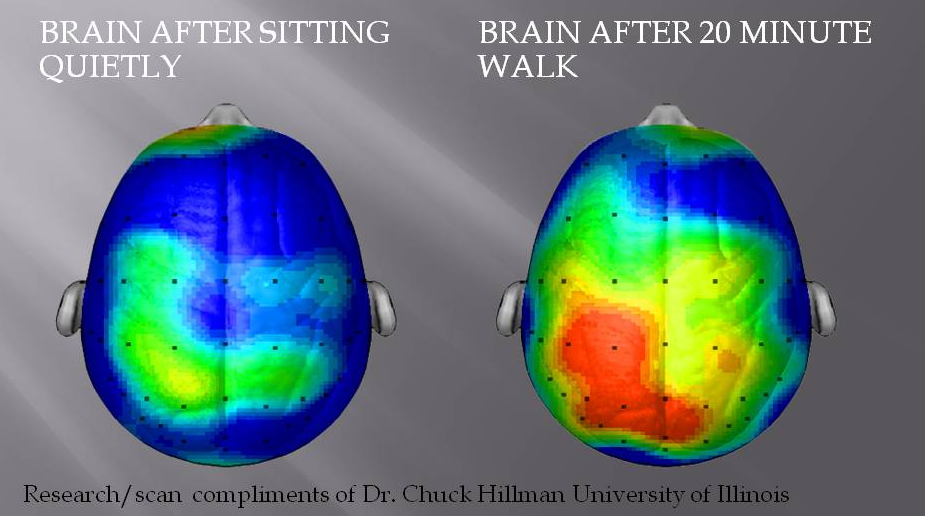 brain scan walk