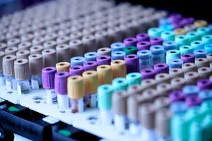 El fármaco de IA de Insilico rebaja 3 años la edad biológica