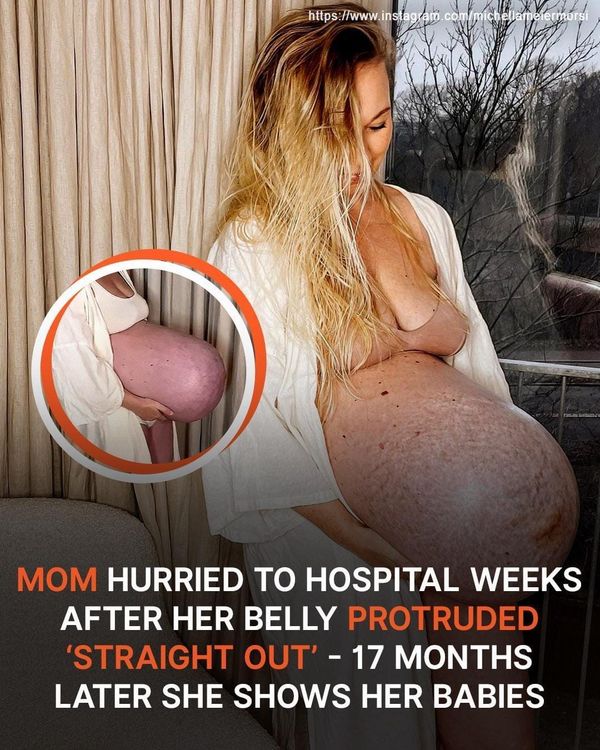 Michella Meier-Morsi, Mom of Triplets, Shocks With Viral Unusual Bump!