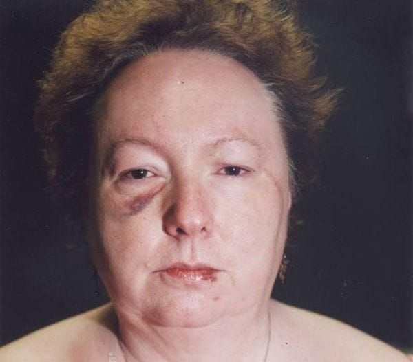 What to Do If Someone Breaks Into Your House: Woman Survives Home Invasion, Kills Intruder in Shocking Act of Self-Defense