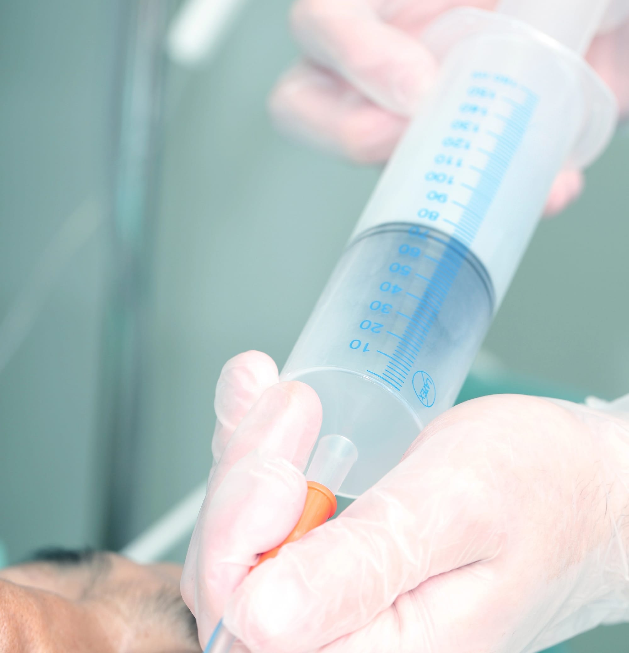 A large syringe administers fluid to a patient's nose. A gloved medical professional performs the procedure in a clinical setting.