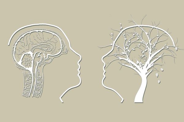 Is There a Link Between Alzheimer's Disease and Brain Fog?