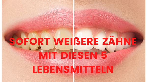 Hocheffektiv und schnell: Zahnaufhellung Zuhause mit diesen 5 Lebensmitteln!