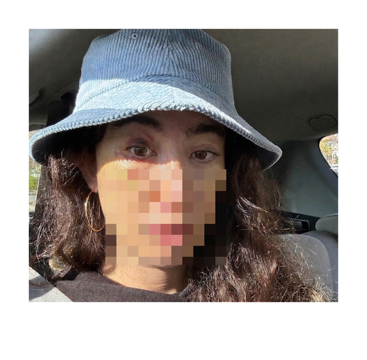 FFS Diaries: Ego Death